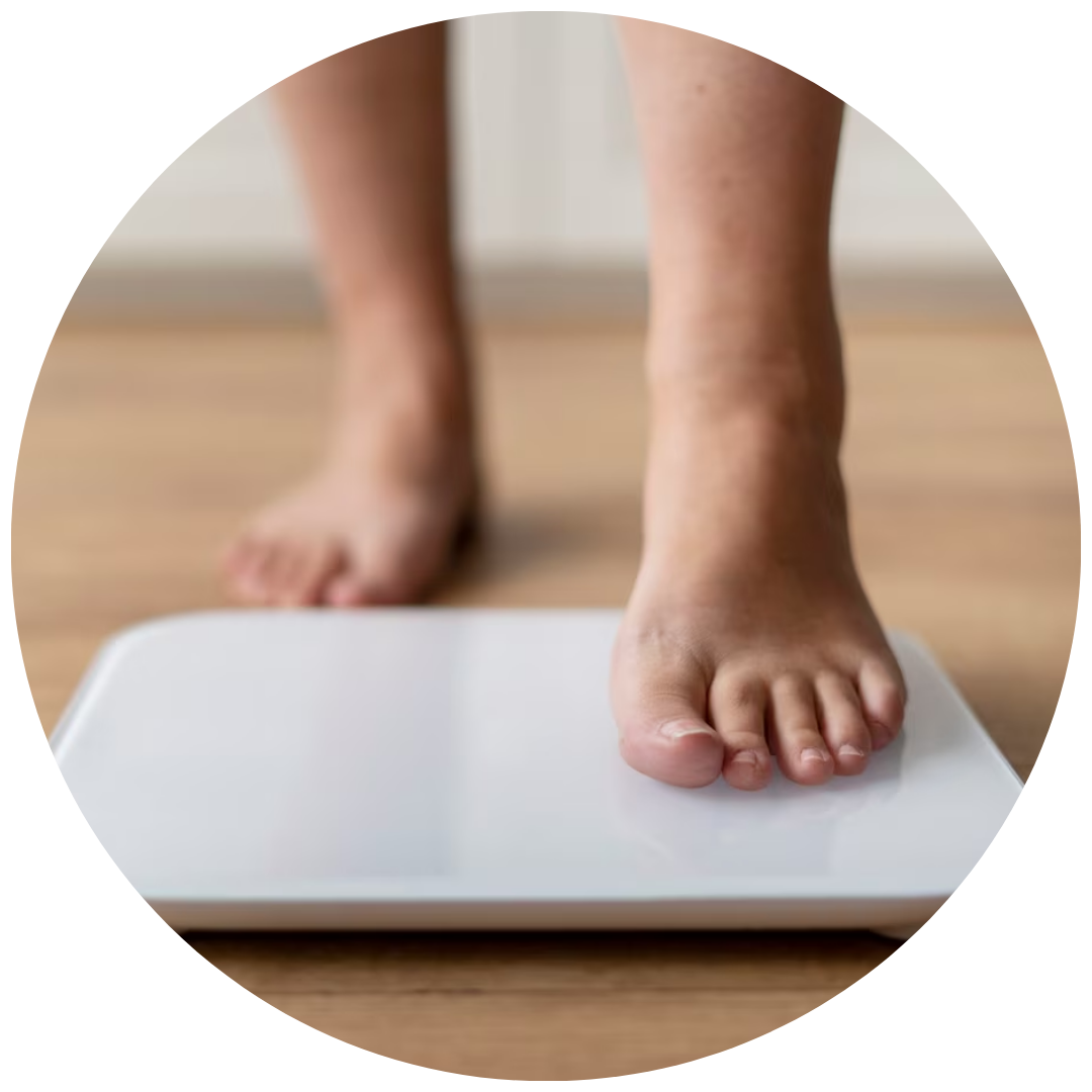 Tratamento obesidade